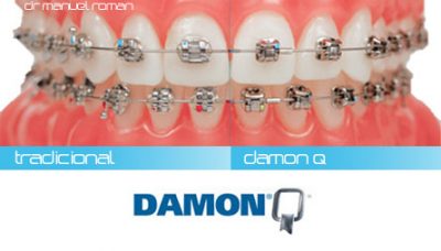 Фото damon q