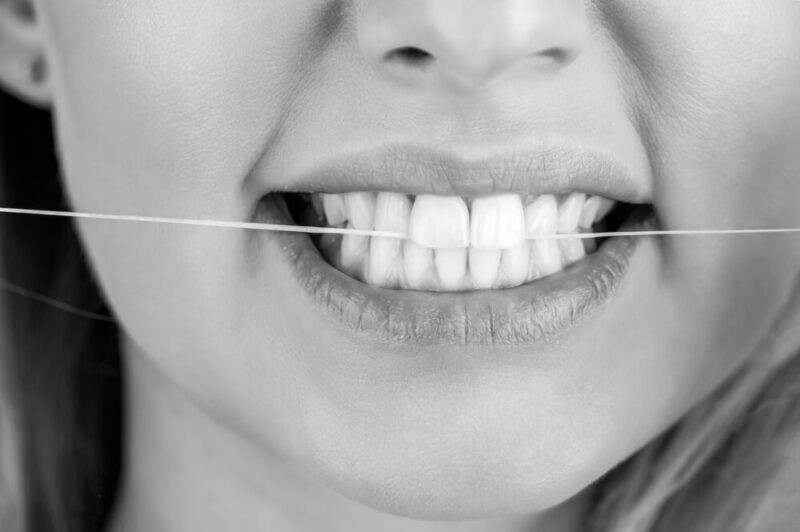 ¿Qué significa diastema dental? - Ortodoncia Malaga